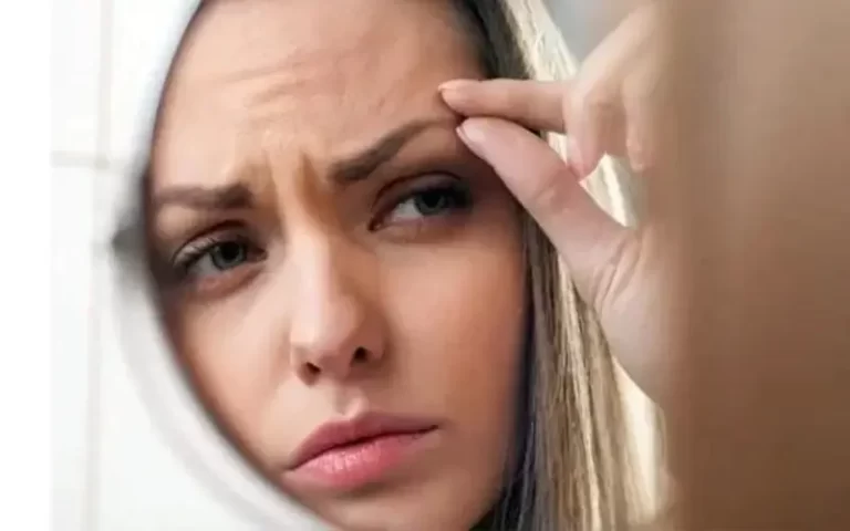 علت خارش ابرو چیست و چطور آن را رفع کنیم؟